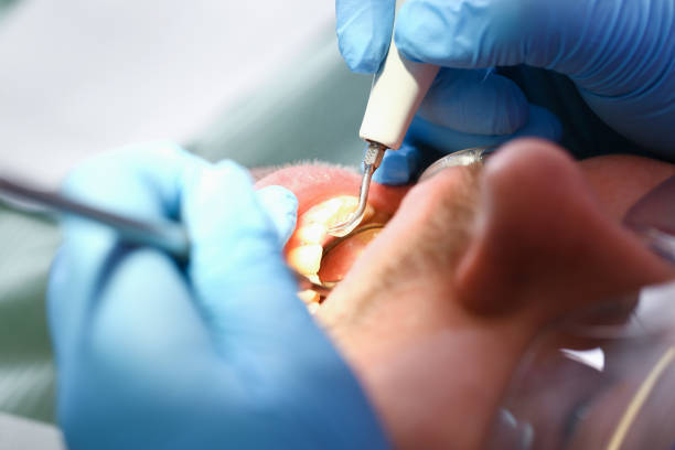 Best Emergency Dentist Near Me  in Druid Hills, GA